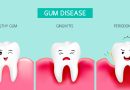 Gum Disease and Mask Mouth